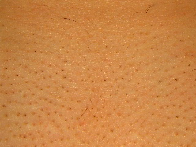 гладкая кожа после лазерной эпиляции
